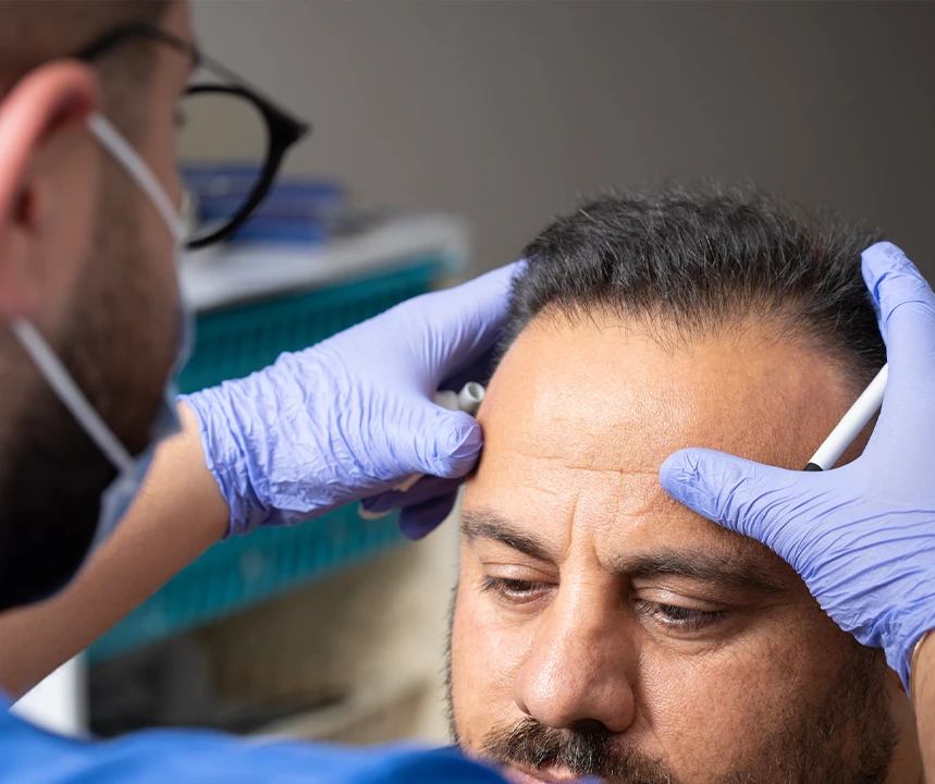 Hair transplant surgeon examining a patient’s hairline during a consultation about FUE hair transplantation.